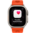 Apple Watch Hermès Ultra 3