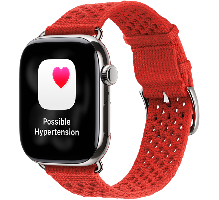 Apple Watch Hermès Series 11